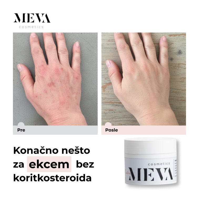 MVK-11-25-12-00 post (2)