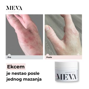 MVK-11-25-12-00 post (3)