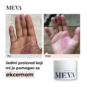 MVK-11-25-12-00 post