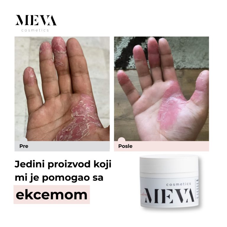 MVK-11-25-12-00 post