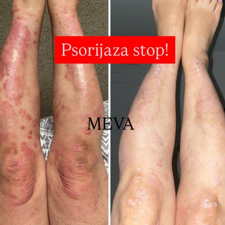 SnapInsta.to_487827953_18052261022516607_4148505992546915495_n